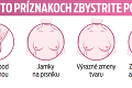 Štát skontroluje ženské prsia: Rozbieha sa celoslovenský skríning, koho sa bude týkať?
