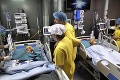 Siamské dvojčatá, ktorým po 33 hodinách oddelili lebky a mozgy: Na toto lekári čakali celé týždne