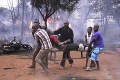 Tragédia v Tanzánii: Výbuch cisterny si vyžiadal už 75 mŕtvych