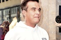 Robbie Williams zaskočil zmenenou tvárou: Šiel na zákrok, ktorý obľubujú ženy