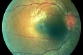 Žena si myslela, že ju oči svrbia kvôli alergii: Šokujúca diagnóza