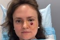 Žena si pod okom našla nenápadný fliačik: Vyšetrenie u lekára odhalilo hrozivú diagnózu