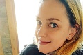 Monika Hilmerová so škaredou ranou na tvári: Priznala, čo sa jej stalo