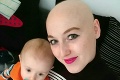 Mamičke kvôli rakovine odstránili prsníky, o pár mesiacov zistila čosi strašné: Toto sa nemalo stať!