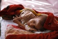 Desivá štatistika z Jemenu: Za tri roky od hladu zomrelo 85 000 detí