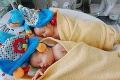 Ťažký osud predčasne narodených dvojičiek z Liptova: Jakubko pomáha chorej sestričke Natálke každý deň!