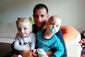 Ťažký osud predčasne narodených dvojičiek z Liptova: Jakubko pomáha chorej sestričke Natálke každý deň!