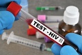 Znepokojivé zistenie: Každý piaty Čech s HIV nevie o tom, že je infikovaný a toto číslo rýchlo stúpa