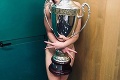 Pikantná oslava titulu: Volejbalistky pózovali s trofejou úplne nahé