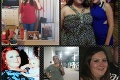 Žena po schudnutí takmer polovice svojej váhy trpí ako nikdy: Uvidíte fotky jej brucha, pochopíte