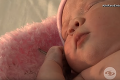 Doktorom sa na ultrazvku naskytol neskutočný pohľad: Takéto bábätko je extrémnou raritou