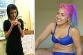 Od 10 rokov bojovala s anorexiou, teraz sa fotí nahá: Odvážne zábery ženy krv a mlieko