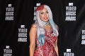 Aspoň si zakryla bradavky... Kontroverzná Lady Gaga zverejnila svoje nahé fotky!
