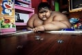 Najtučnejšie dieťa sveta schudlo neskutočných 100 kíl: Sledujte fotky po premene!