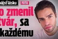 Youtuber nevie nájsť lásku: To, ako zmenil svoju tvár, sa nepáči každému