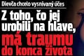 Dievča chcelo vysnívaný účes: Z toho, čo jej urobili na hlave, má traumu do konca života