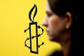 Mimovládky, podľa Amnesty International, čelia globálnemu útoku: Zákony proti nim platia v desiatkach krajín