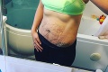 Fitnesska zverejnila fotku brucha dva roky po pôrode dvojičiek: Uff, toto ani sama nečakala