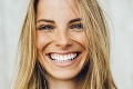 Pozor na domáce bielenie zubov: Aké riziká sa spájajú s túžbou po hollywoodskom úsmeve?