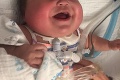 Dievčatko sa narodilo o 17 týždňov skôr a viac sa z nemocnice nedostalo: Po 3 rokoch prišiel zvrat!