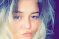 Blondínka si zmenila profilovú fotku na Facebooku: Frajer jej za to vybil zuby