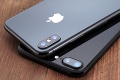 Mladík kvôli novému iPadu a iPhonu predal obličku na čiernom trhu: Hrozivé následky rozhodnutia