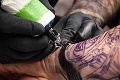 Zbav sa zlého tetovania a získaj svetový unikát