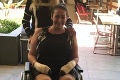 Tamare povedali, že má zápal pľúc, a s liekmi ju poslali domov: Po 2 mesiacoch prišla o nohy a ruku!