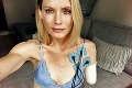 Kaskadérka Olivia žiada mastné odškodné: Obetovala svoju ruku pre Millu Jovovich