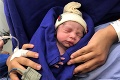 Unikátny pôrod v Brazílii: Narodilo sa prvé dieťa z transplantovanej maternice mŕtvej ženy