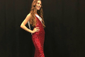 Miss Supranational 2018: Dánsko reprezentuje kráska s nedokonalosťou, ktorá ju robí výnimočnou