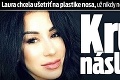 Laura chcela ušetriť na plastike nosa, už nikdy nebude taká, ako predtým: Kruté následky!