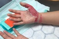 Tínedžerka si upravovala akrylové nechty, spravila jednu osudnú chybu: Odvtedy trpí v hrozných bolestiach