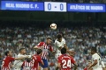 Na Real sa to valí z každej strany: Madridu sa zranil dôležitý hráč