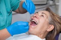 Vláda odobrila zmenu pre zubárov: Musia používať menej amalgámových plomb