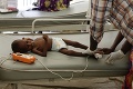 Hrozivé správy z UNICEF-u: Vlani zomrelo na svete každých päť sekúnd jedno dieťa