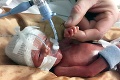 Rozkošné bábätko čakajú smutné vyhliadky: Ľudí s takou diagnózou je na svete len 100