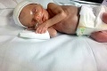 Rozkošné bábätko čakajú smutné vyhliadky: Ľudí s takou diagnózou je na svete len 100