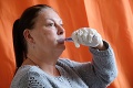 Bývala zdravotná sestra sa sprchuje len 2-krát ročne: Alergia na vodu mi ničí život