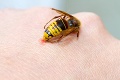 Počas leta útočí hmyz častejšie: Bodnutie môže skončiť smrťou
