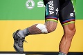 To najhoršie z Tour de France: Hororový pád, operácia so zošívačkou a zakrvavený Sagan