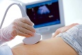Ministerstvo zdravotníctva zavádza nové čakačky na vyšetrenia: Ako dlho budeme čakať na sono či mamograf?!