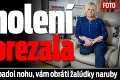 Pri holení sa porezala: Hnus, ktorý jej napadol nohu, vám obráti žalúdky naruby