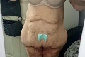 Žena, ktorá schudla viac ako 110 kilogramov, zverejnila fotku jej tela: Muži ju teraz s odporom odmietajú