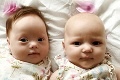 Mamička Nicola porodila dvojičky: Lekári neverili vlastným očiam, šanca, že sa toto stane je 1 k miliónu