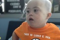 Rodičia svojmu synovi oholili hlavu kvôli rakovine: Z tých fotiek vám pukne srdce