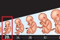 Polícia vyšetruje šokujúci prípad nelegálneho potratu v Petržalke: Odtrhli nenarodenému dieťatku hlavičku?!