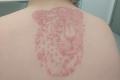 Mama dala deťom na Malorke spraviť tetovanie hennou: Z dovolenky si priniesli bolestivú pamiatku