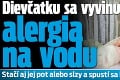 Dievčatku sa vyvinula vzácna alergia na vodu: Stačí aj jej pot alebo slzy a spustí sa bolestivá reakcia