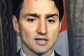 Kanadský premiér zažil poriadny trapas: Keď si všimnete detail na jeho tvári, neprestanete sa smiať